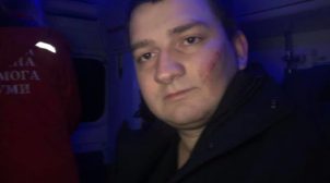 В Сумах неизвестные побили нардепа от «Слуги народа». ФОТО