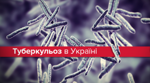 Минздрав предупредил об эпидемии туберкулеза