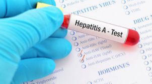 У Одеській області виявили осередок вірусного гепатиту А