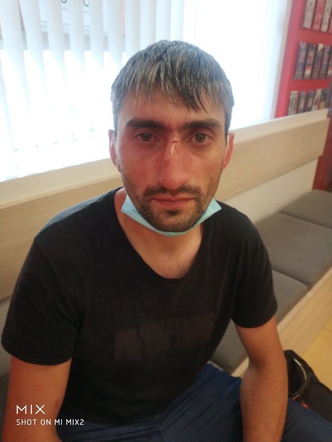 В Киеве побили антимайдановца «Топаза» В Киеве побили антимайдановца «Топаза»