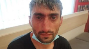 В Киеве побили антимайдановца «Топаза»