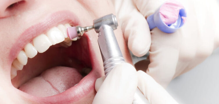 (Рус) Подготовка к Новому году: чистка и отбеливание зубов в стоматологии